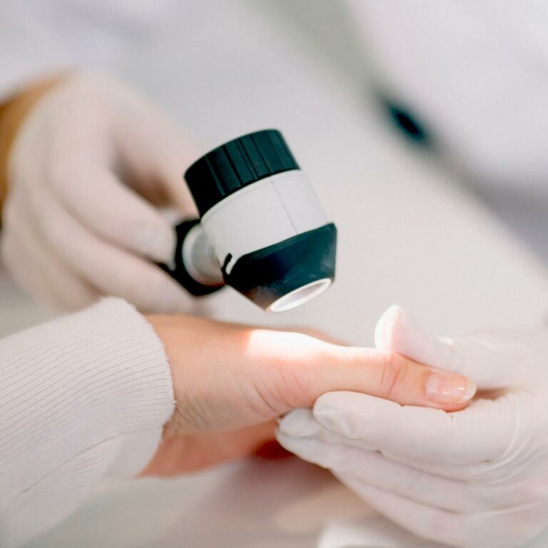 Hautarzt Hannover Kirchrode Bemerode Die Dermapraxis